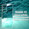 Ally Xiaomi 12 Kılıf Kamera Korumalı Ultra İnce Şeffaf Silikon Kılıf-(5775)