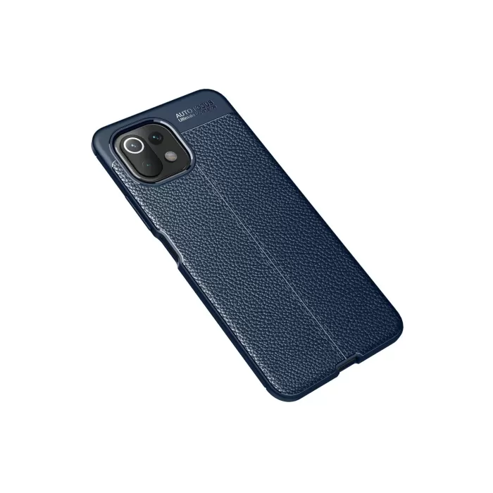 Newface Xiaomi Mİ 11 Lite Kılıf Auto Focus Kapak - Lacivert