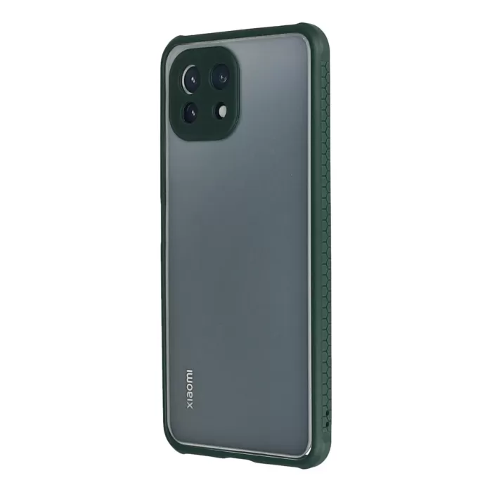 Newface Xiaomi Mİ 11 Lite Kılıf Miami Şeffaf Silikon - Koyu Yeşil