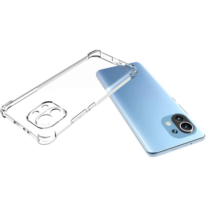 Xiaomi Mi 11 Kamera Korumalı Shockproof Darbe Emici Silikon Kılıf-(5775)