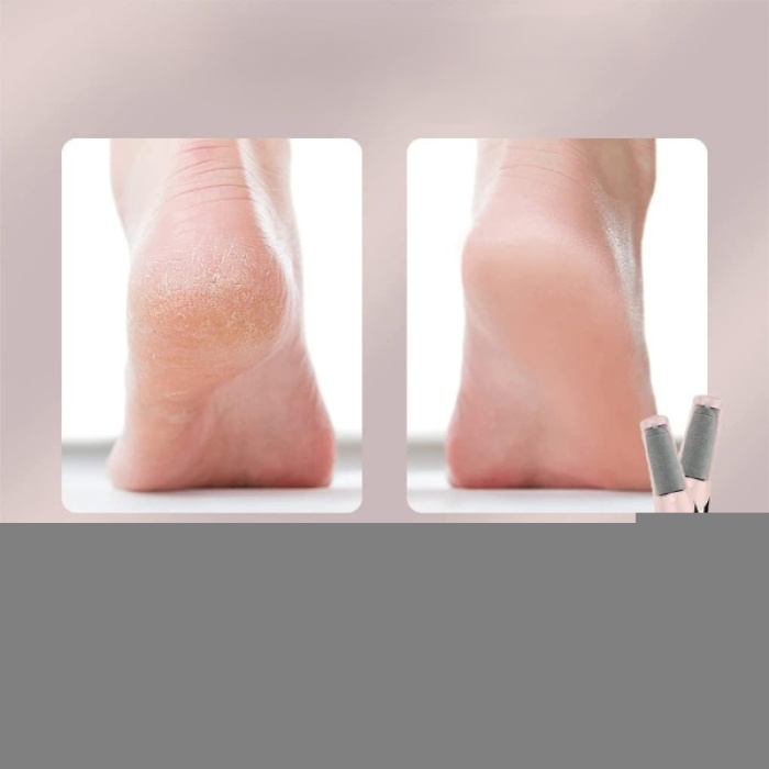 Şarjlı Ayak Törpüsü - Pedikür ve Ayak Bakım Aleti