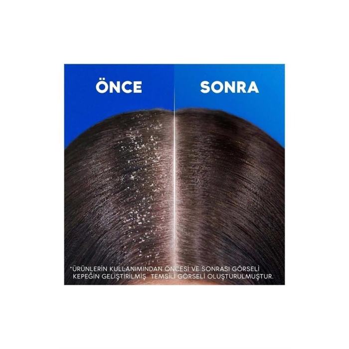 Head&Shoulders Şampuan 330Ml. Dökülme Karşıtı