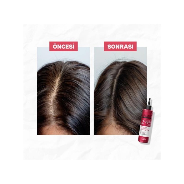 Urban Saç Tonik 200Ml No:2 Apple Cider