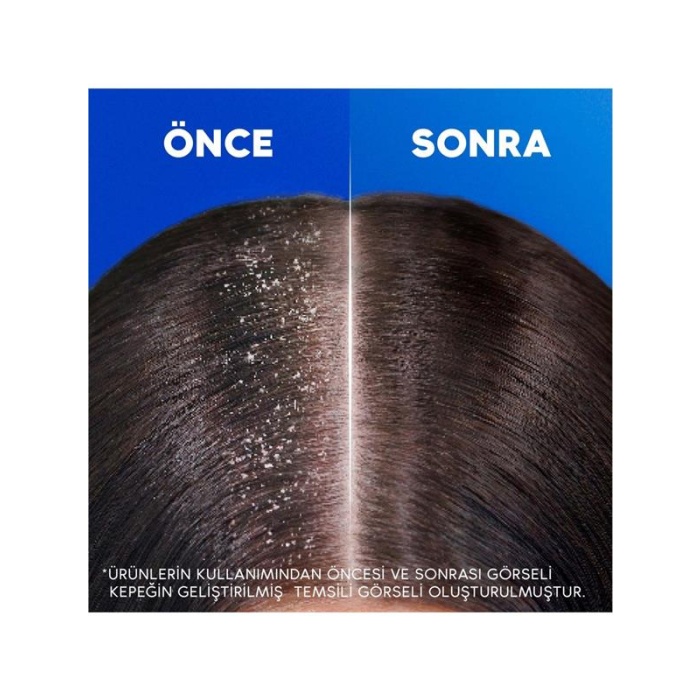 Head&Shoulders Şampuan 330Ml. Sensitive