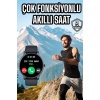Akıllı Saat Çok Fonksiyonlu Sesli Görüşme NFC Uyumlu Amoled Ekran -