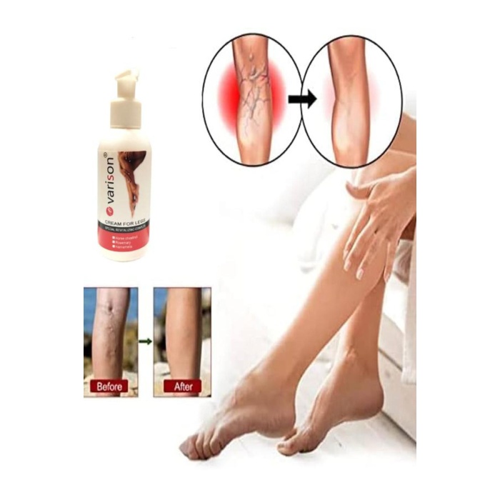 on Vari.s Sellülit Bacak Bakım Kremi 120 ml
