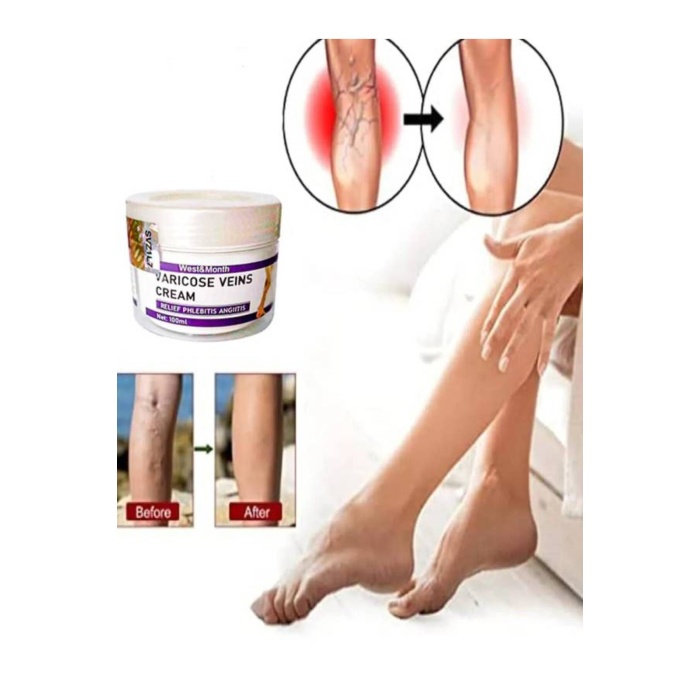 West & Month Varicose Vein Var.is Karşıtı Masaj Bakım Kremi 100 ml