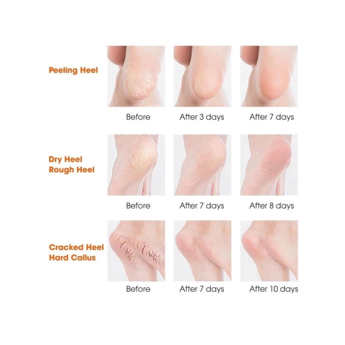 Silikon Topuk Nemlendirici Çorap -