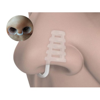 Horlama Burun Aparatı Kafesli