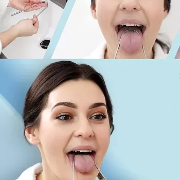 ® Yeni Ürün Metal Dil Temizleme Aleti