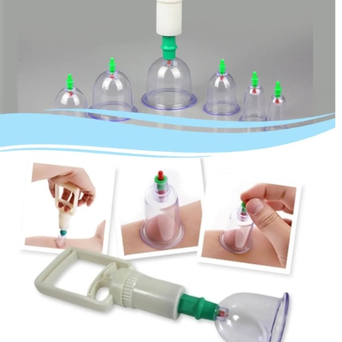 ® Hacamat Seti Hortumlu - Vakumlu Hortumlu Kupa Çekme Seti (Model 1)