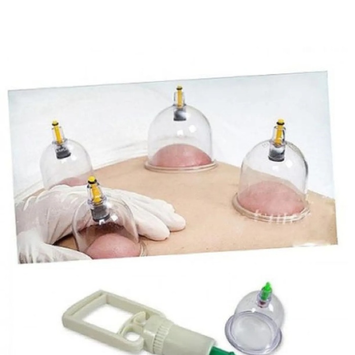 ® Hacamat Seti Hortumlu - Vakumlu Hortumlu Kupa Çekme Seti (Model 3)