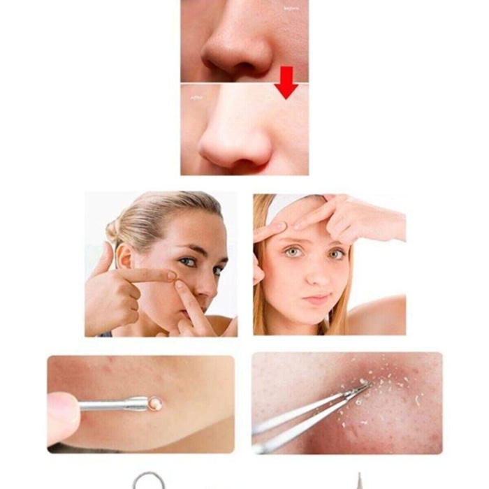 ® 4 lü Kutulu Paslanmaz Komedon Akne - Siyah Nokta Temizleyici Set
