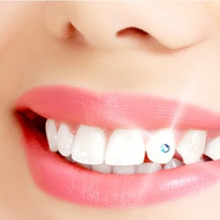 ® Diş Kristali ve Diş Pırlantası Komple Set - Muhteşem Gülüş Seti