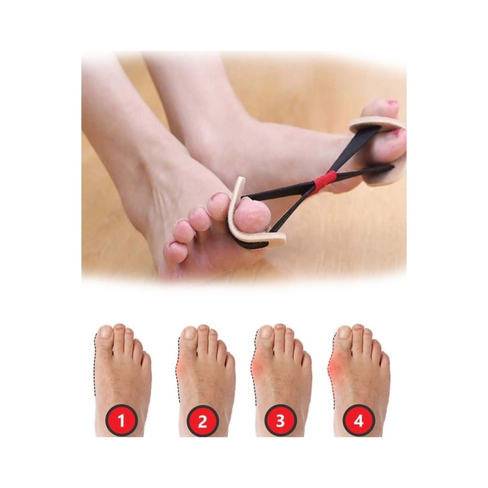 ® Ayak Baş Parmak Kemik Düzeltici Egzersiz Lastiği