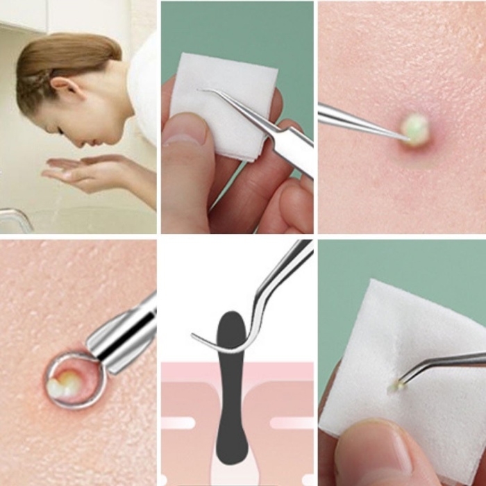 Biyomak® 11 Parça Siyah Nokta Temizleyici Cilt Bakım Komedon Seti