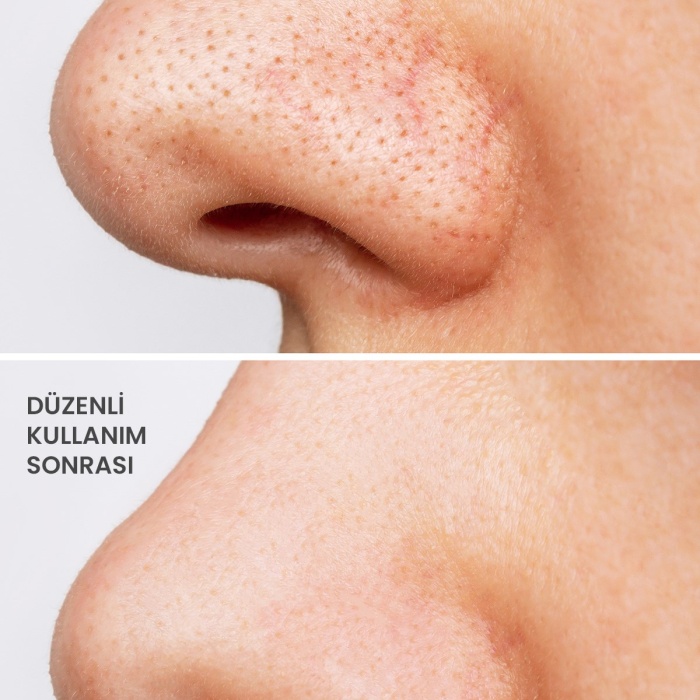 ® Yeni Ürün Kolajen Kil MaskesiLeke ve Siyah Nokta Giderici Yüz Maskesi Collagen Clay Mask 125g