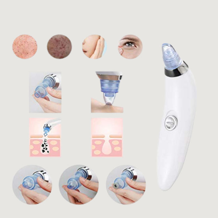 KESGİN MARKET ® Cilt Dostu Vakumlu Siyah Nokta Temizleyici – Siyah Nokta, Yağ ve Makyaj Kalıntılarına Karşı