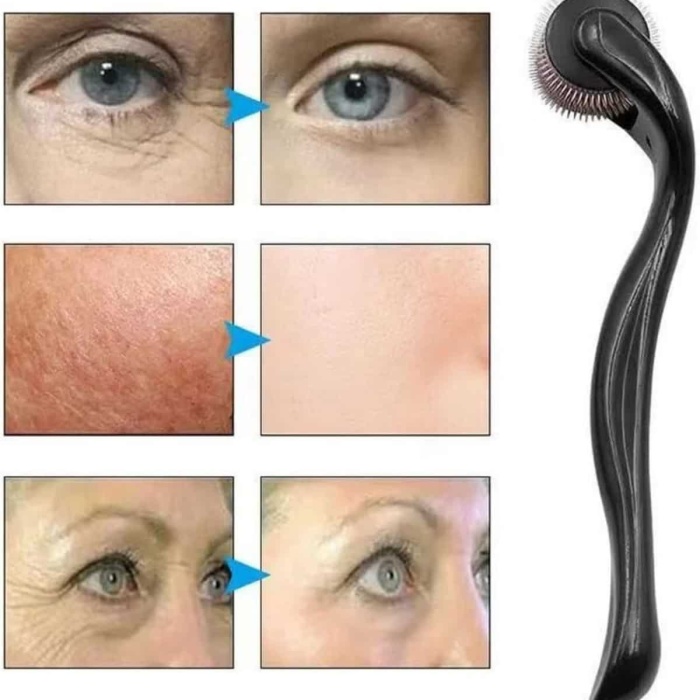 KESGİN MARKET ® Dermaroller Titanyum 540 Iğneli 1 Mm Saç Kaş Sakal Serum Kullanıma Uygun