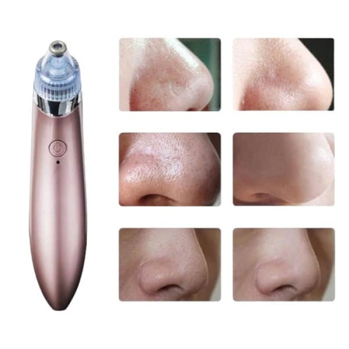 KESGİN MARKET ® SİYAH NOKTA CİHAZI