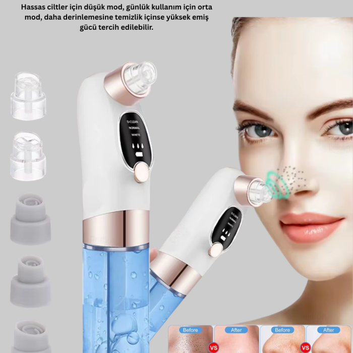 KESGİN MARKET® Ayarlanabilir Güç Seviyeli Vakumlu Siyah Nokta Temizleme Cihazı – Derin Gözenek Temizliği
