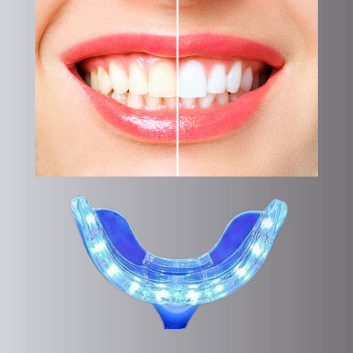 Led Işıklı Profesyonel Diş Beyazlatma Seti