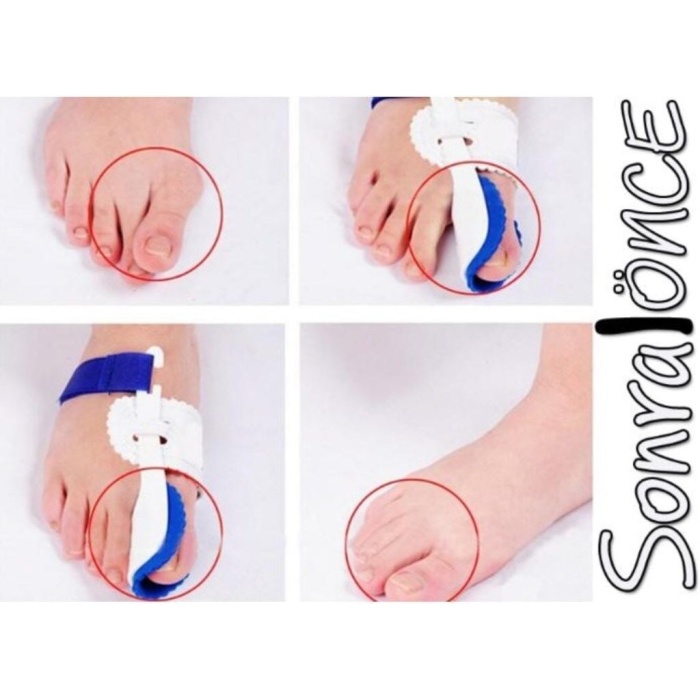 Baş Parmak Kemik Düzeltici Gece Ateli (Çift) - Lisinya