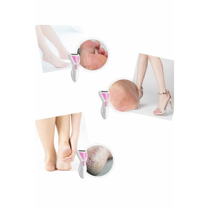 Epilatör Cihazı Epilasyon Aleti Çoklu Başlık Seçeneği Ayak Törpüsü - Lisinya