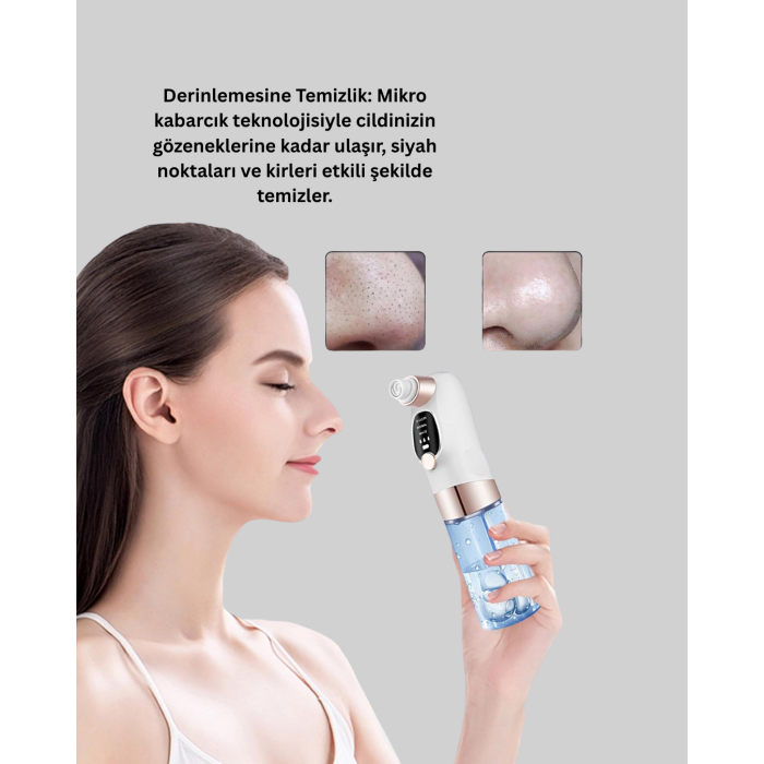 Elektrikli Siyah Nokta Sökücü – Derinlemesine Gözenek Temizleme Cihazı - Lisinya