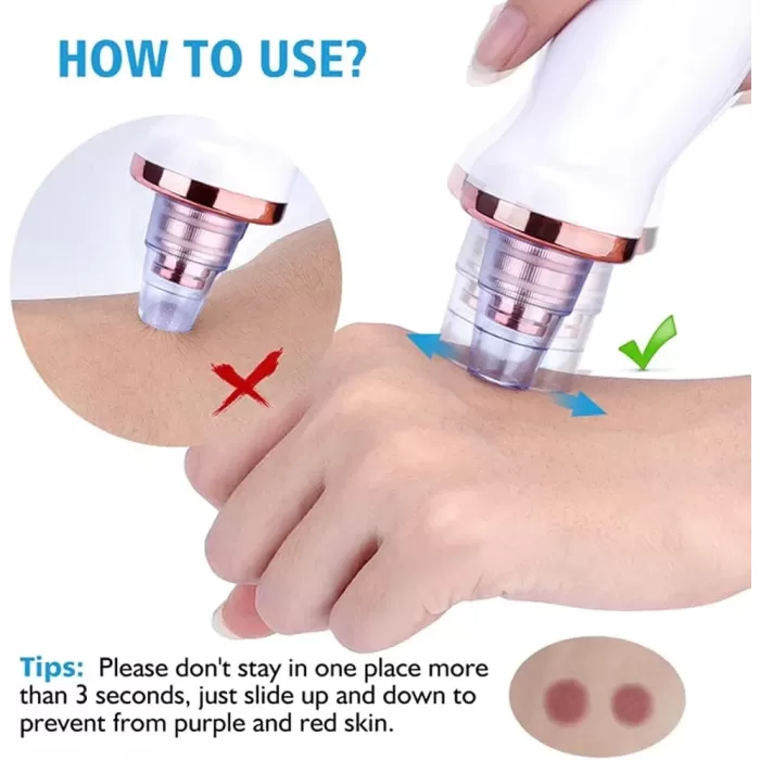 Şarjlı Siyah Nokta Temizleme Cihazı 5 Başlıklı (5343)