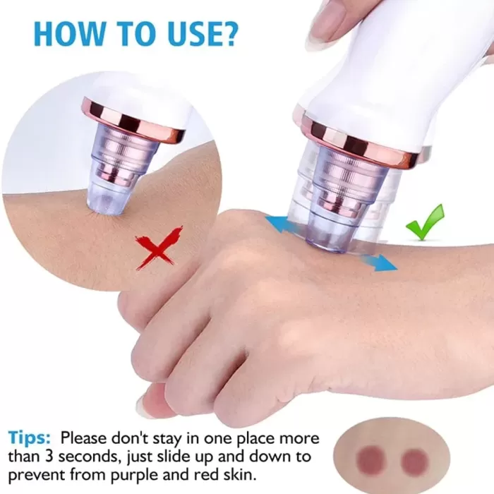 Şarjlı Siyah Nokta Temizleme Cihazı 5 Başlıklı (5343)