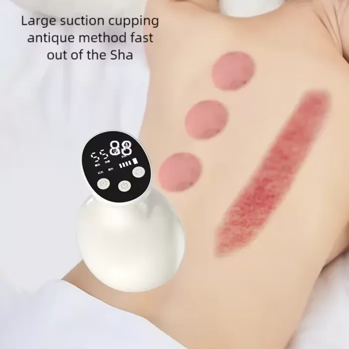 Sıcaklık Emişli Bardak Çekme Terapisi, Vakumlu Masaj Aleti,Terapi Cihazı Masaj Cihazı (5343)