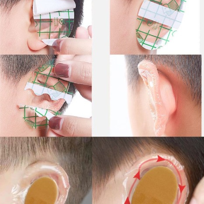 Su Geçirmez Yapışkanlı Kulak Koruyucu Bant 10 lu Paket (5343)
