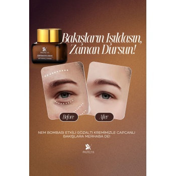 Yaşlanma Karşıtı Göz Kremi – Kaz Ayağı ve Bakım