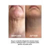Anti-Aging Krem – Nemlendirici ve Kırışıklık Karşıtı Yüz & Boyun Bakım Kremi
