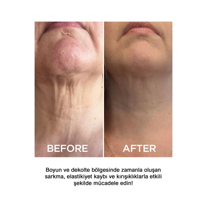Anti-Aging Krem – Nemlendirici ve Kırışıklık Karşıtı Yüz & Boyun Bakım Kremi