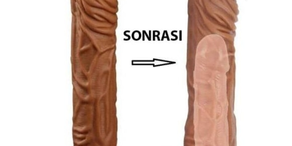 Penis kılıfı Nedir?