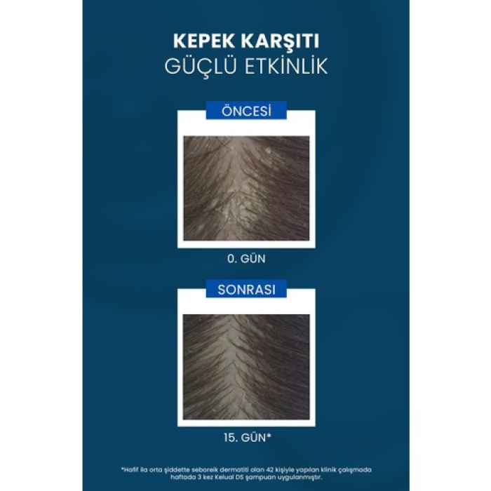 Ducray Kelual Ds Şampuan 100 Ml