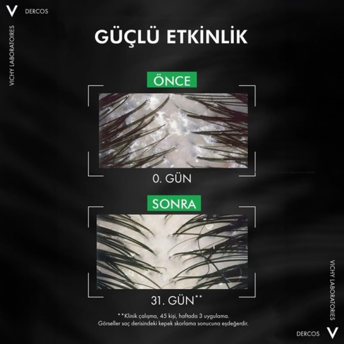 Vichy Dercos Anti-Pelliculaire Anti-Dandruff Kepek Karşıtı Şampuan 390 Ml - Kuru Saçlar