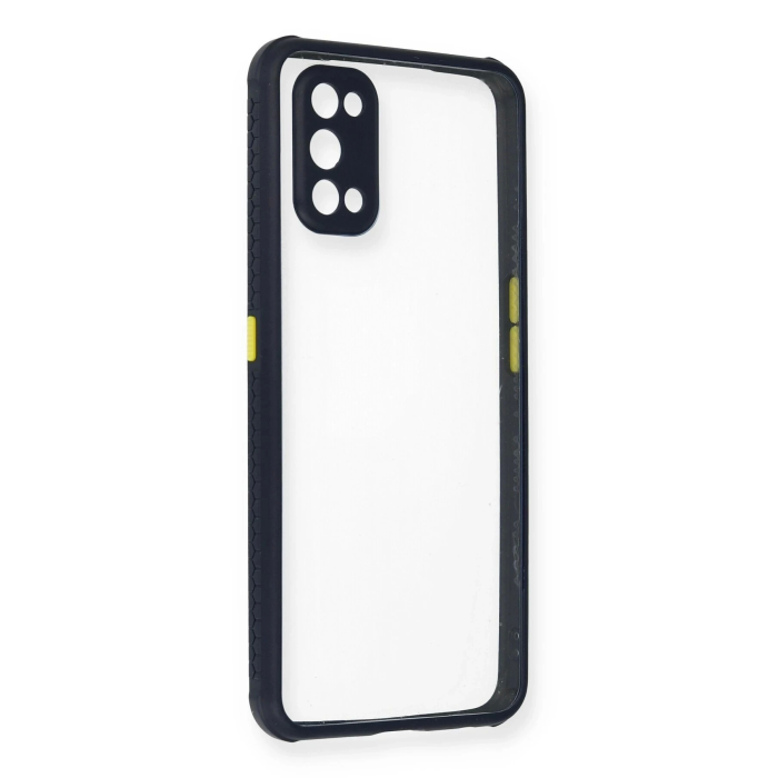 BFS  Realme 7 Pro Kılıf Miami Şeffaf Silikon - Lacivert