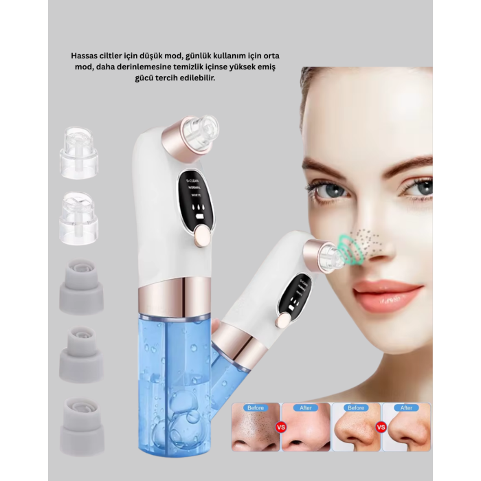 3 Kademeli Vakumlu Gözenek Temizleme Cihazı – Cilt Yenileyici Masaj ve Derin Temizlik