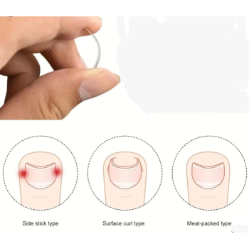 Baş Parmak Tırnak Batmasını Engelleyen Metal Aparat Nrd 603 *