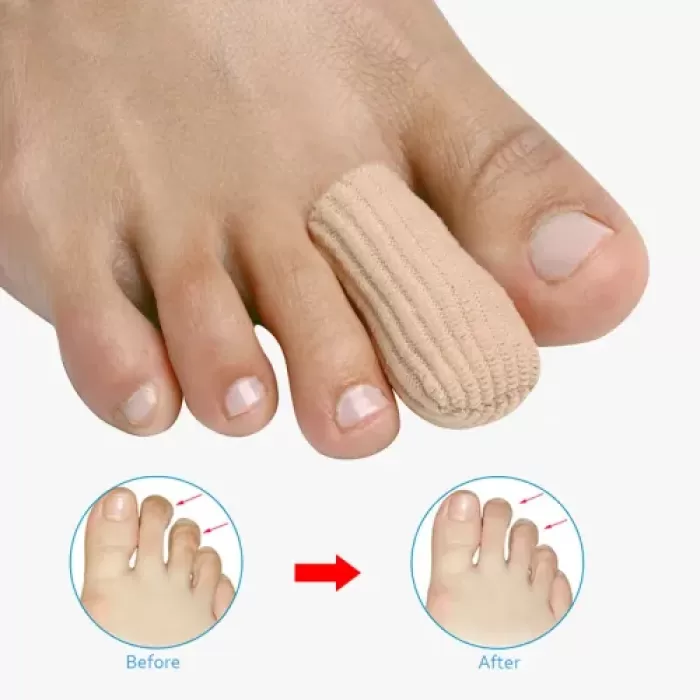 Silikon Kumaş Kaplı Nasır Koruyucu Hortum