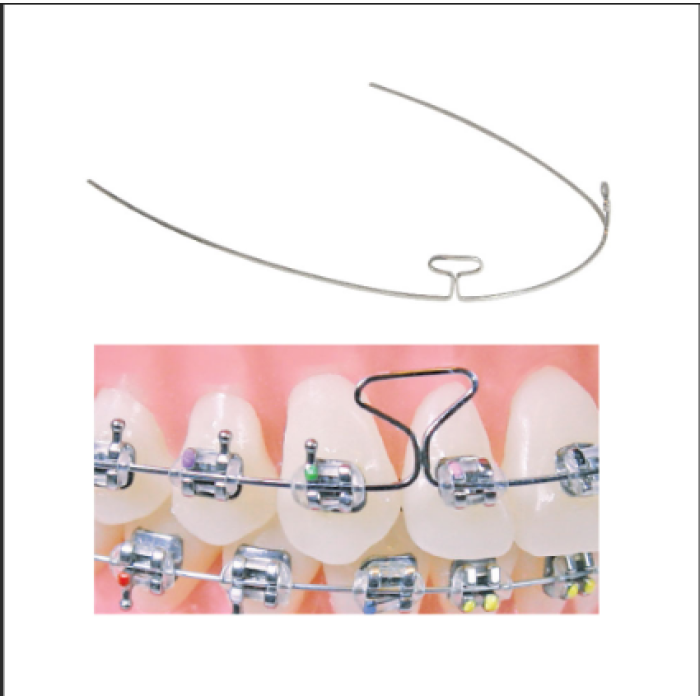 TMA Double Loop Wires (Mashroom Teller)