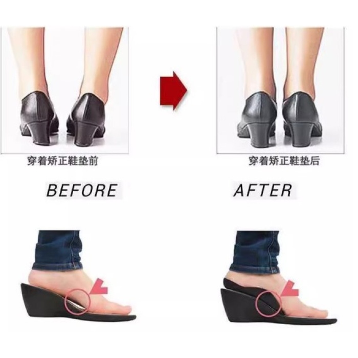 Esnek Düz Taban Düzeltici Topuk Yastığı (4915) Go-53-vice/(1395)