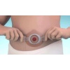 BRAVA OSTOMİ KEMERİ