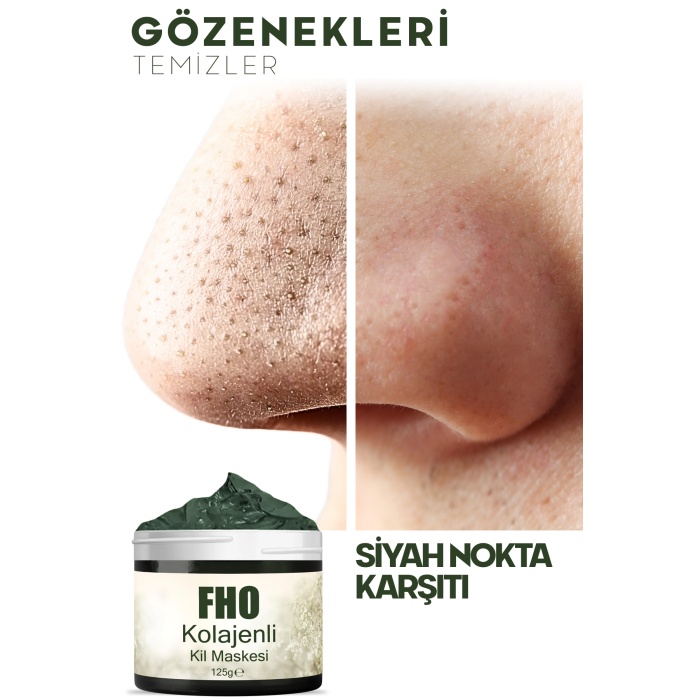 FHO Siyah Nokta - Akne ve Sivilce Karşıtı Kolajenli Kil Maskesi 125gr