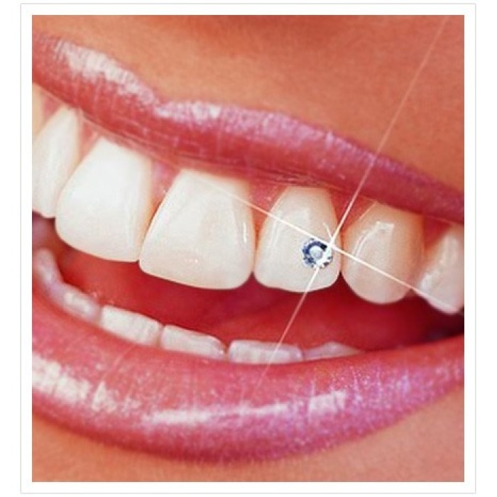 Grck Elit Diş Kristali Ve Diş Pırlantası 5 Adet Muhteşem Gülüş Seti Efsn