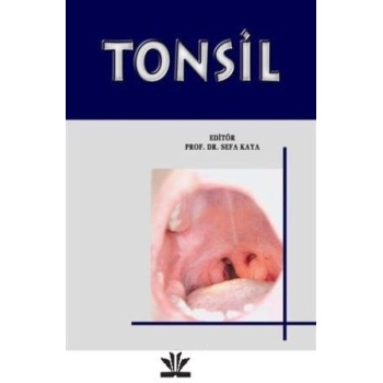 TONSİL