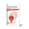 BİLİMSEL GÖZLE, HALKIN DİLİYLE KRONİK PROSTATİT